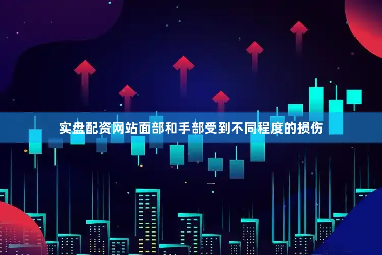 实盘配资网站面部和手部受到不同程度的损伤